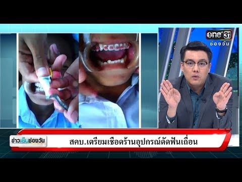 สคบ.เตรียมเชื่อดร้านอุปกรณ์ดัดฟันเถื่อน | จั๊ด ซัดทุกความจริง | ข่าวช่องวัน | ช่อง one31