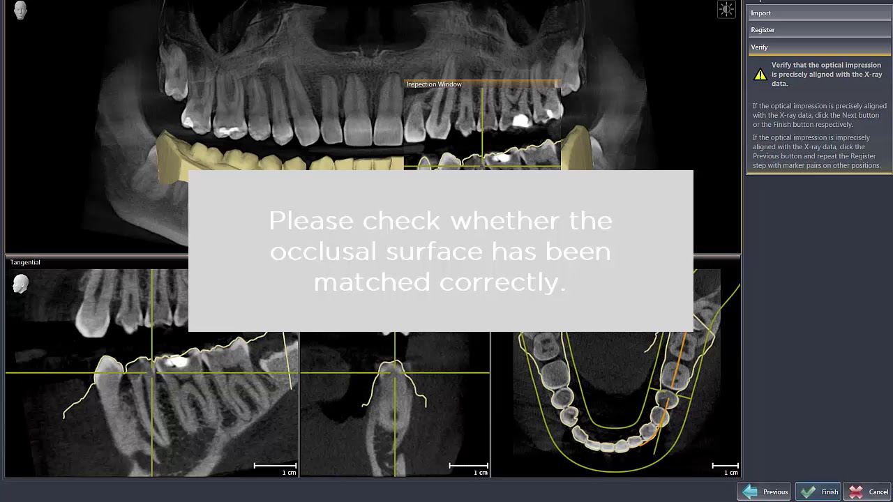 SICAT ENDO, CAD/CAM Integration - YouTube