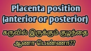 Placenta position \/\/How to find a girl or boy baby\/\/Gender prediction in tamil