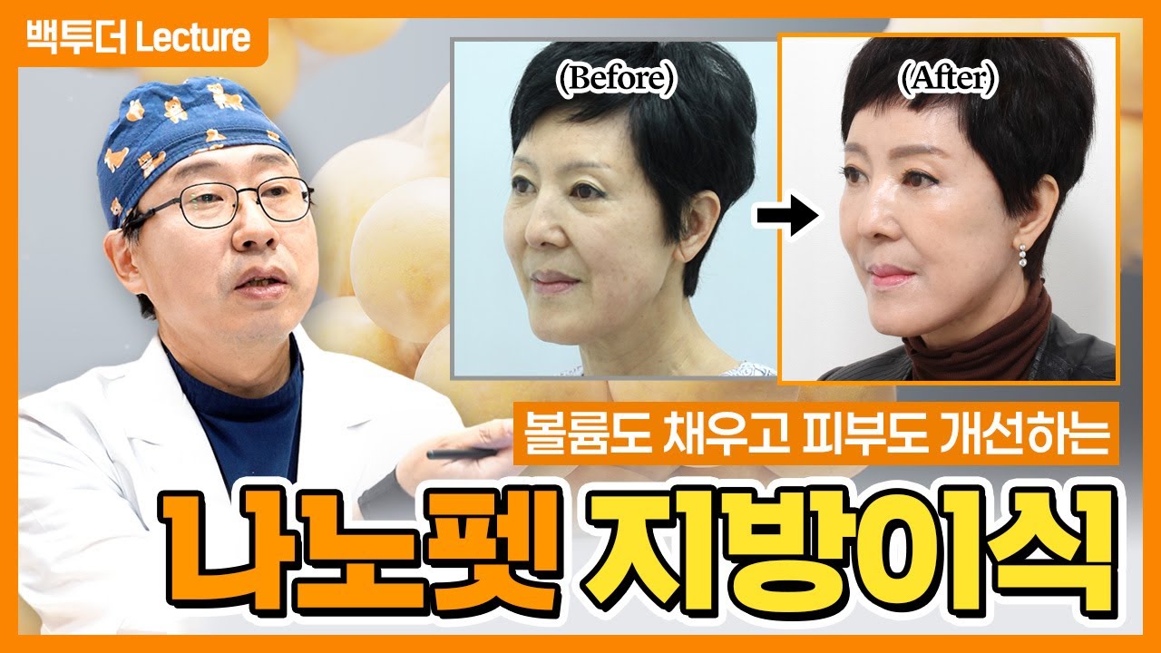 [얼굴지방이식] 부위별로 다르게 해야 하는 이유! ※미세지방이식!※