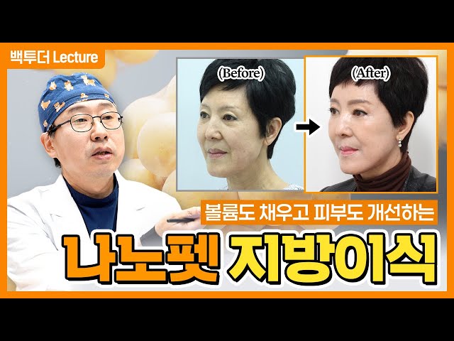 [얼굴지방이식] 부위별로 다르게 해야 하는 이유! ※미세지방이식!※
