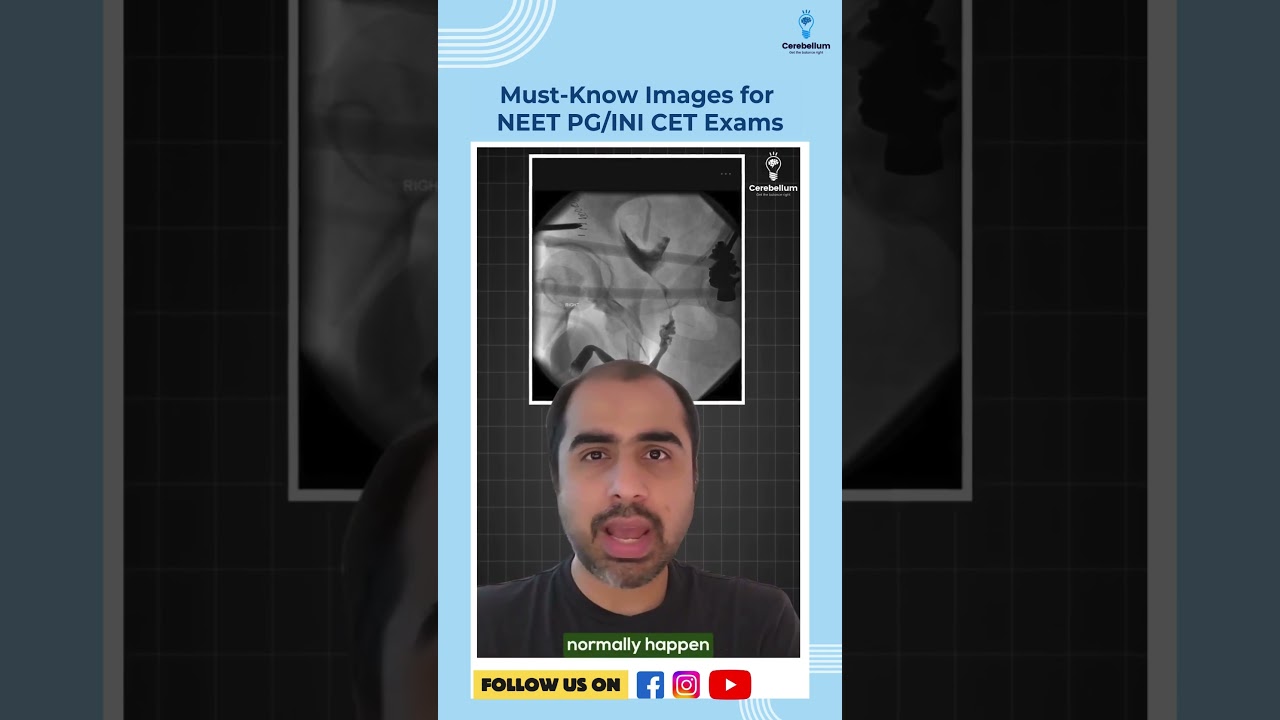 3 Must Know Images for NEET PG/INI CET | Dr. Amrit Nasta