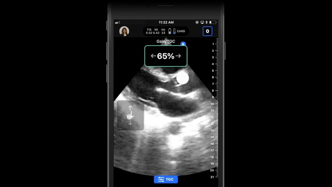 luthfiannisahay: Butterfly Iq Customer Service Number