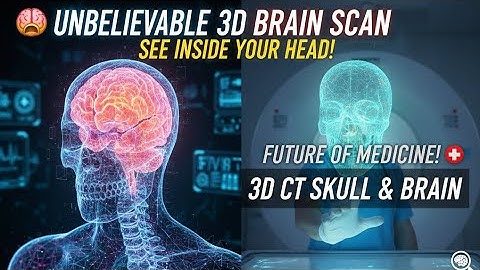 🤯  3D CT Scan of the Human Skull & Brain | Must See Anatomy #ctscan #radiology 