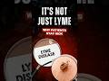 Chronic Lyme Is Rarely “Just Lyme” | Mold, Coinfections &amp; Why Patients Stay Sick