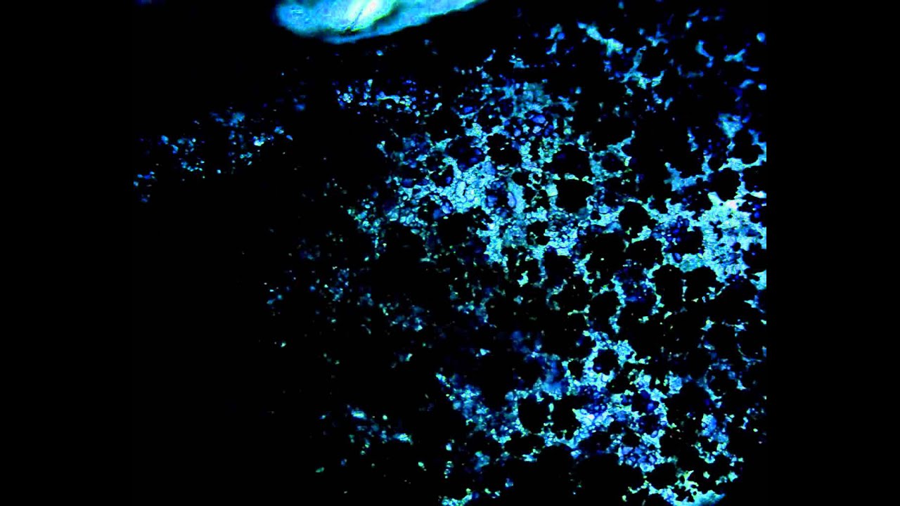 Potato cells exposed to iodine YouTube