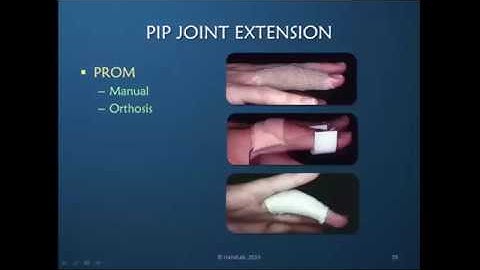 Obstinate PIP Joint: Part 6 of 12: Regaining PIP Joint Extension