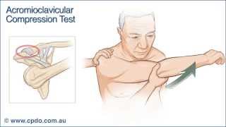 Acromioclavicular Compression Test - Chiropractic Online CE™