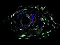JID February 2024 Cover: SARS-CoV-2 from Skin Lesion to Ultrastructure