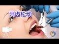 牙医教你牙齿松动该怎么办？|牙齿保健Fit Loose Teeth and Gums