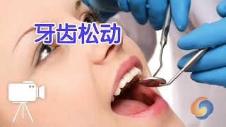 牙医教你牙齿松动该怎么办？|牙齿保健Fit Loose Teeth and Gums