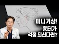 미니거상 후 흉터가 남는 게 걱정되시나요?