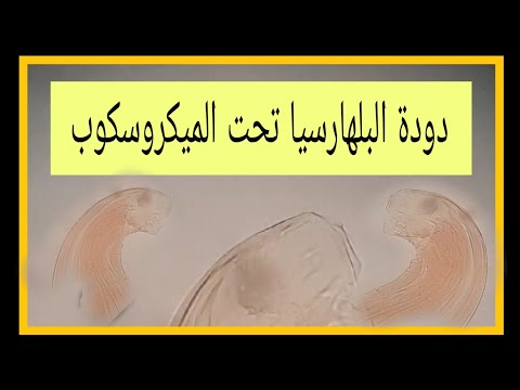 دودة البلهارسيا تحت الميكروسكوب صور دقيقة
