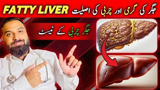 What Is Fatty Liver Fatty Liver Treatment And Causes By Dr Mujtaba.
