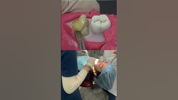 Răng khôn mọc “dưới đáy của xã hội” lôi lên như thế nào? Nha khoa Thành An