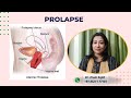 Prolapse | DNB Theory Class | DNB OBGYN coaching All India chapter | Live Class