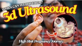 Induction Date Revealed? + 3D Ultrasound Update!