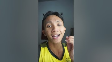 prompt chat gpt unity #shorts #unity #chatgpt #ai #gamedev #programming #indiegame #code #openai