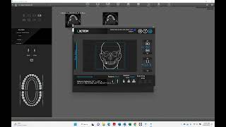 Acteon "X-Mind Prime with Ceph acquisition
