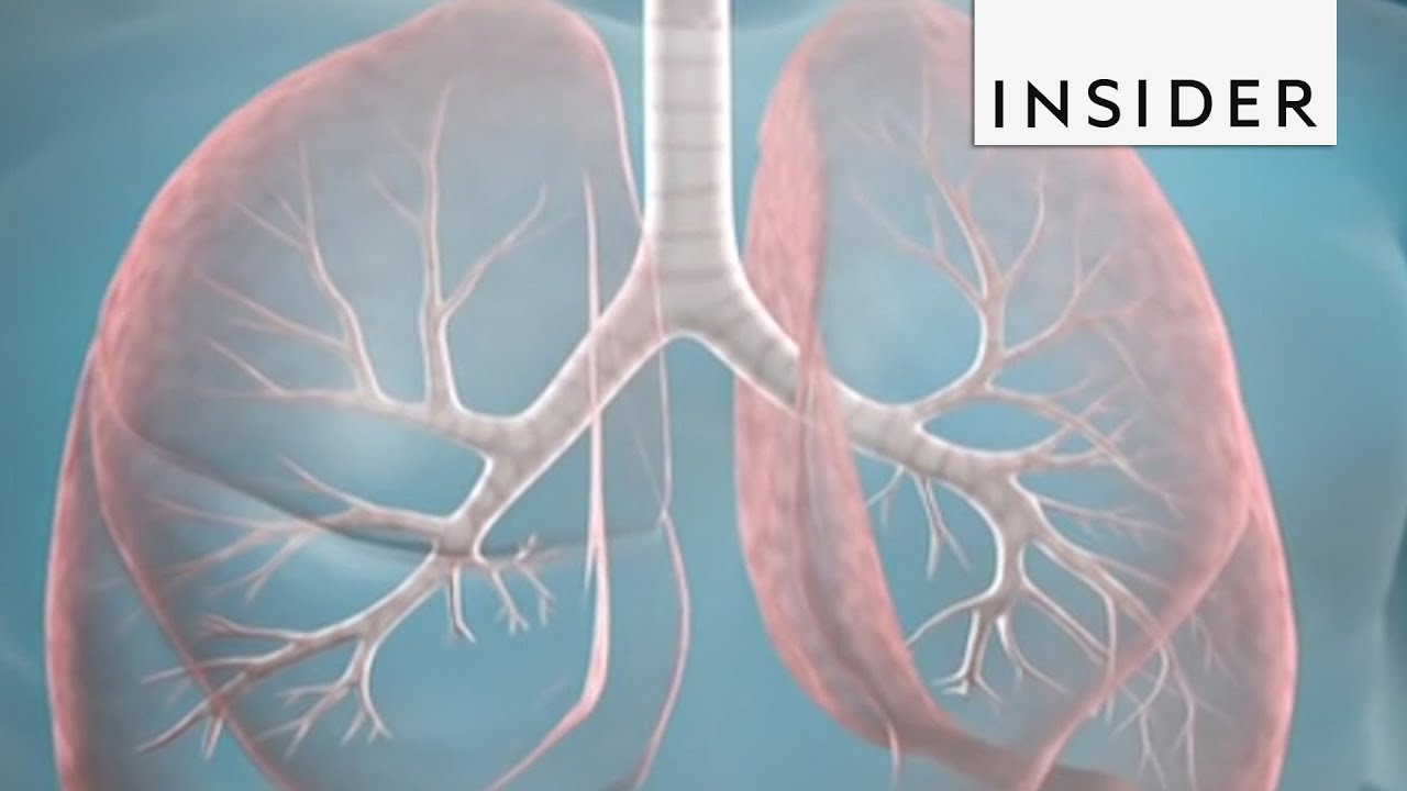 This Procedure Could Help Treat Severe Asthma YouTube