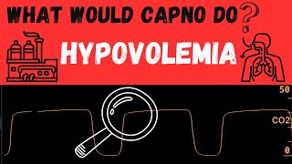 What would CAPNO do Hypovolemia