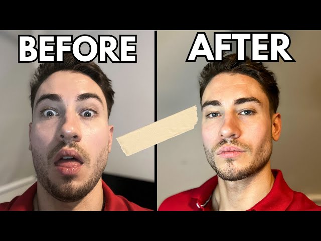 NexCare Mouth Tape Review (Affordable Somnifix Alternative?)