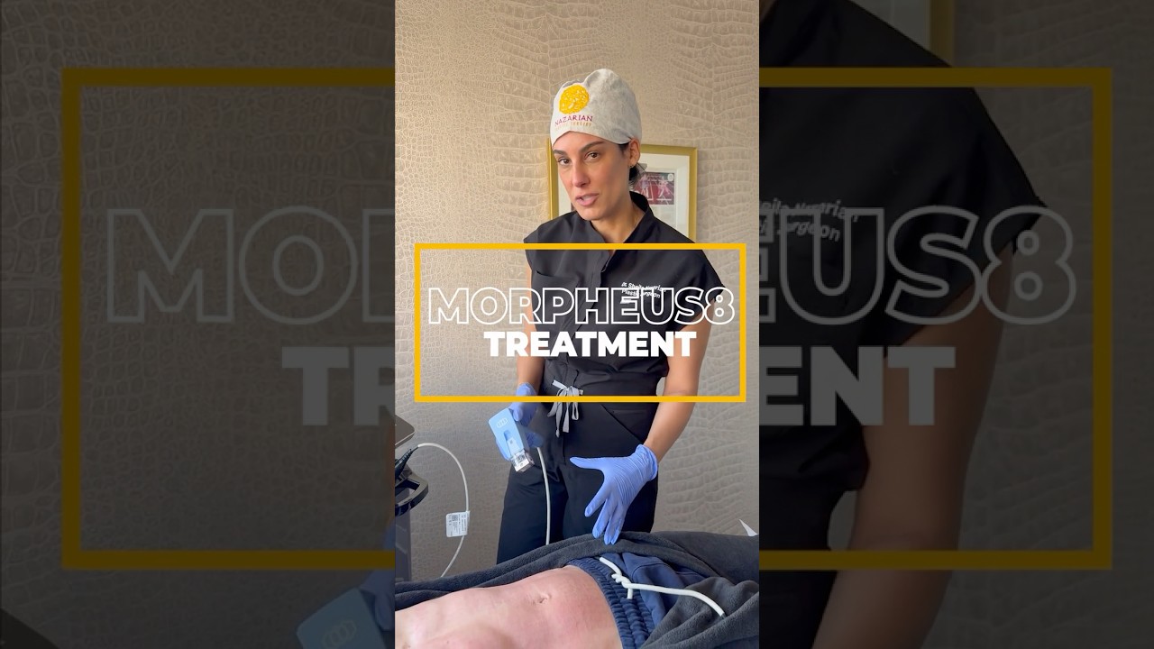 Why Morpheus8? Top Benefits of This Skin Rejuvenation Treatment