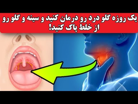 تصویری: نحوه درمان مچ پا متورم (همراه با تصاویر)