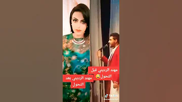 مهند الرديني قبل وبعد 