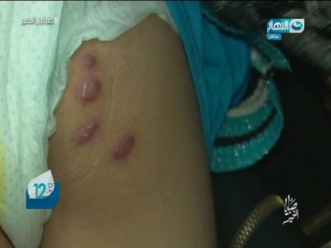 صبايا الخير طفلة صغيرة تتعرض لأبشع أنواع العنف والتعذيب ولن تصدق من المتسبب فى ذلك 