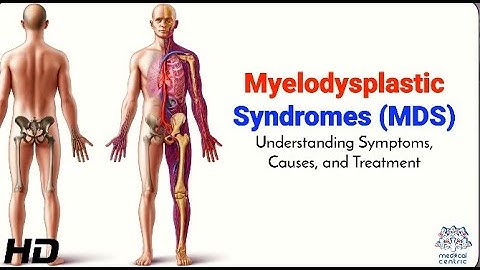 Myelodysplastic Syndromes (MDS): Symptoms, Diagnosis, and Treatment