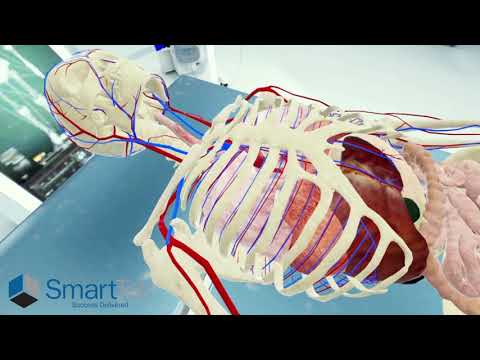 TAVR Operation - video from SmartTek Solutions