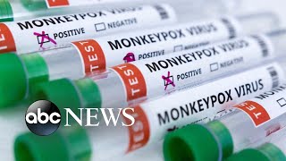 ‘It certainly is a concerning figure’: WHO monkeypox expert on US cases l ABCNL