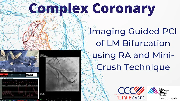 Imaging Guided PCI of LM Bifurcation using RA and Mini-Crush Technique