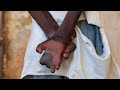 Ukoma Matende Mshipa Wa Kushuka Na Minyoo Tunaangazia Magonjwa Yaliyotelekezwa Sehemu 1 Ukoma Matende Mshipa Wa Kushuka Na Minyoo Tunaangazia Magonjwa Yaliyotelekezwa Sehemu 1