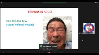មេរៀនពេទ្យ Tetanus in adult Dr  Han Ramonn CPD 23062023