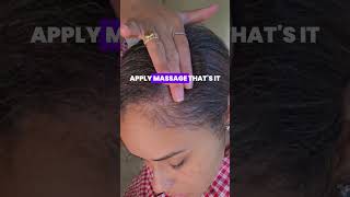 DIY Rosemary Castor Oil Serum for Incredible Hair Growth - Easy Recipe battlehairloss haircare