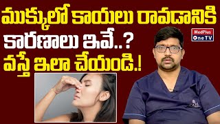 Causes Of Nasal Polyps.? Treatment.? | Dr.VinayKumar | @MedPlusONETV