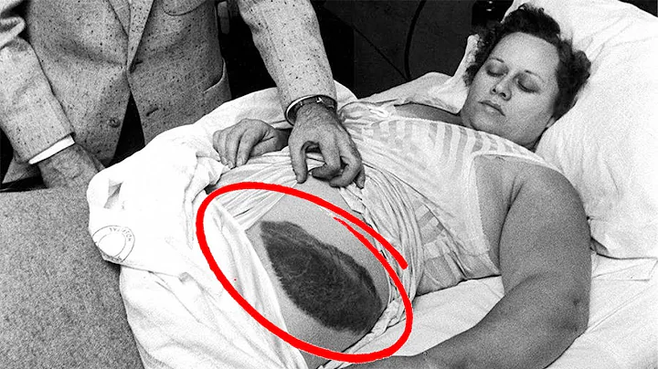 She Was Hit By A Meteorite | The Story of Ann Hodges