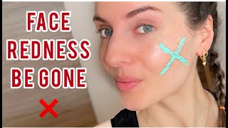 BEST ANTI-REDNESS MAKEUP/SKIN CARE PRODUCT? | Rosalique 3 in 1 Anti-Redness Miracle Formula | Review