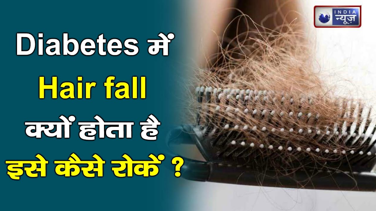 Hair fall Diabetes में बालो का झड़ना कैसे रोके Hair Fall Cure Tips Medically Speaking