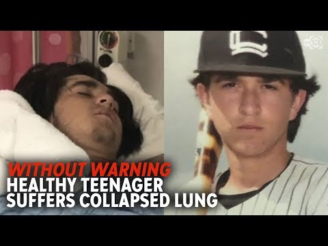 Video: Zacjeljuje li se djelomično kolabirana pluća?