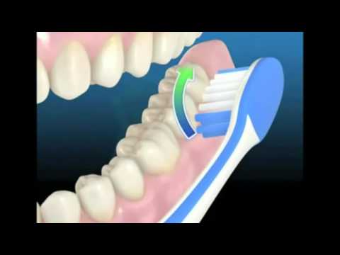 Video: Cum Afectează Alimentele Sănătatea Dentară A Câinilor? - Alimentele Pot Menține Sănătos Dinții Câinilor?