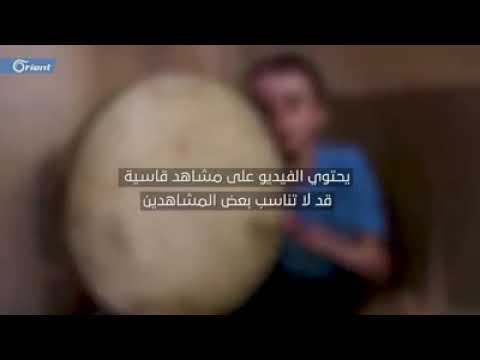 ينشد للوطن ولا يستطيع العلاج به