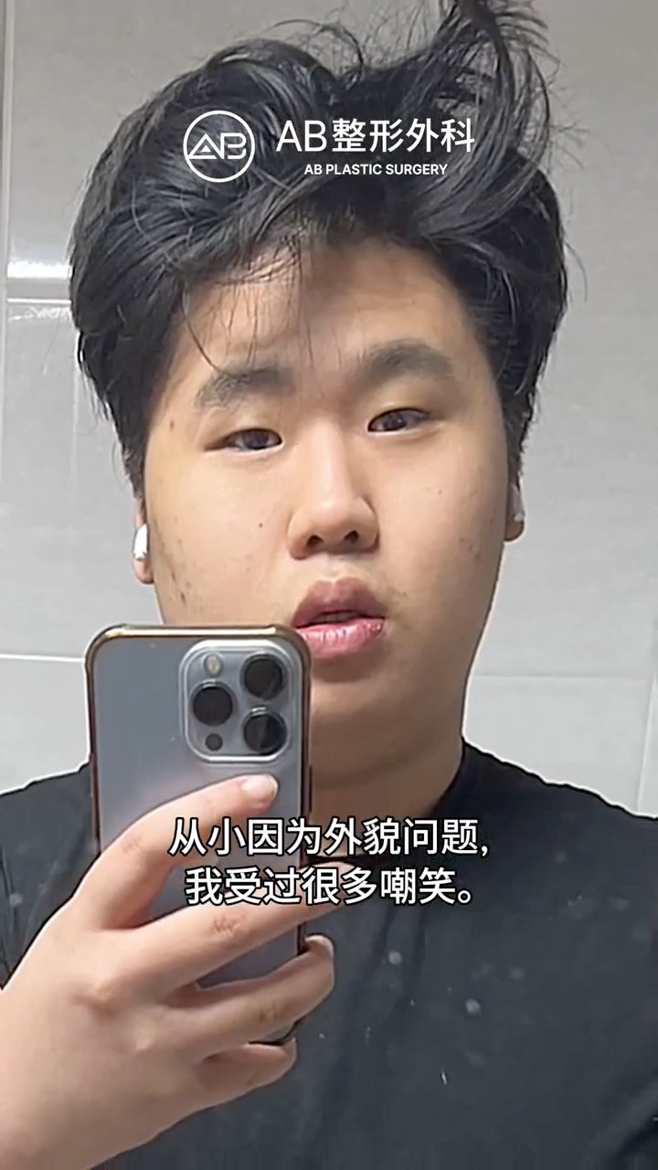 嘴凸困擾多年，我選擇在韓國做手術的原因 #shorts