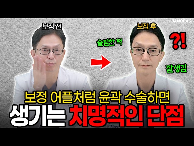 보정 어플 얼굴 그대로 수술하면 생기는 일🔥 보정 어플 vs 윤곽수술, 결정적 차이 💣윤곽수술, 어플처럼 안 나오는 이유🙏