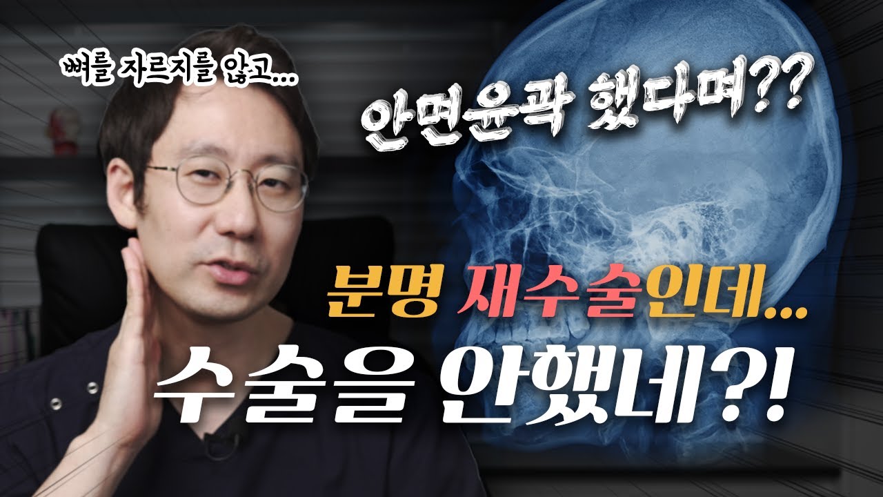 안면윤곽수술로 뼈를 너무 많이 자른 경우에는 어떻게 하나요??