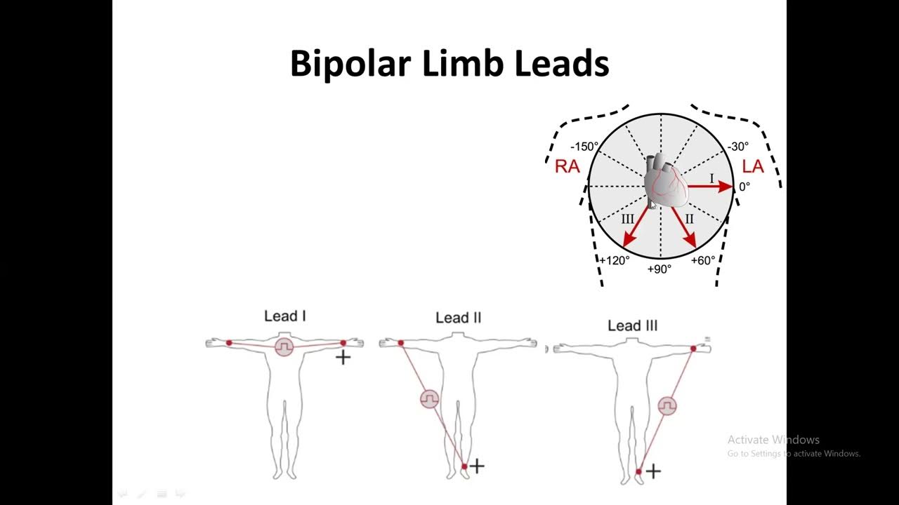 3 Bipolar Limb Leads and Unipolar Limb leads YouTube