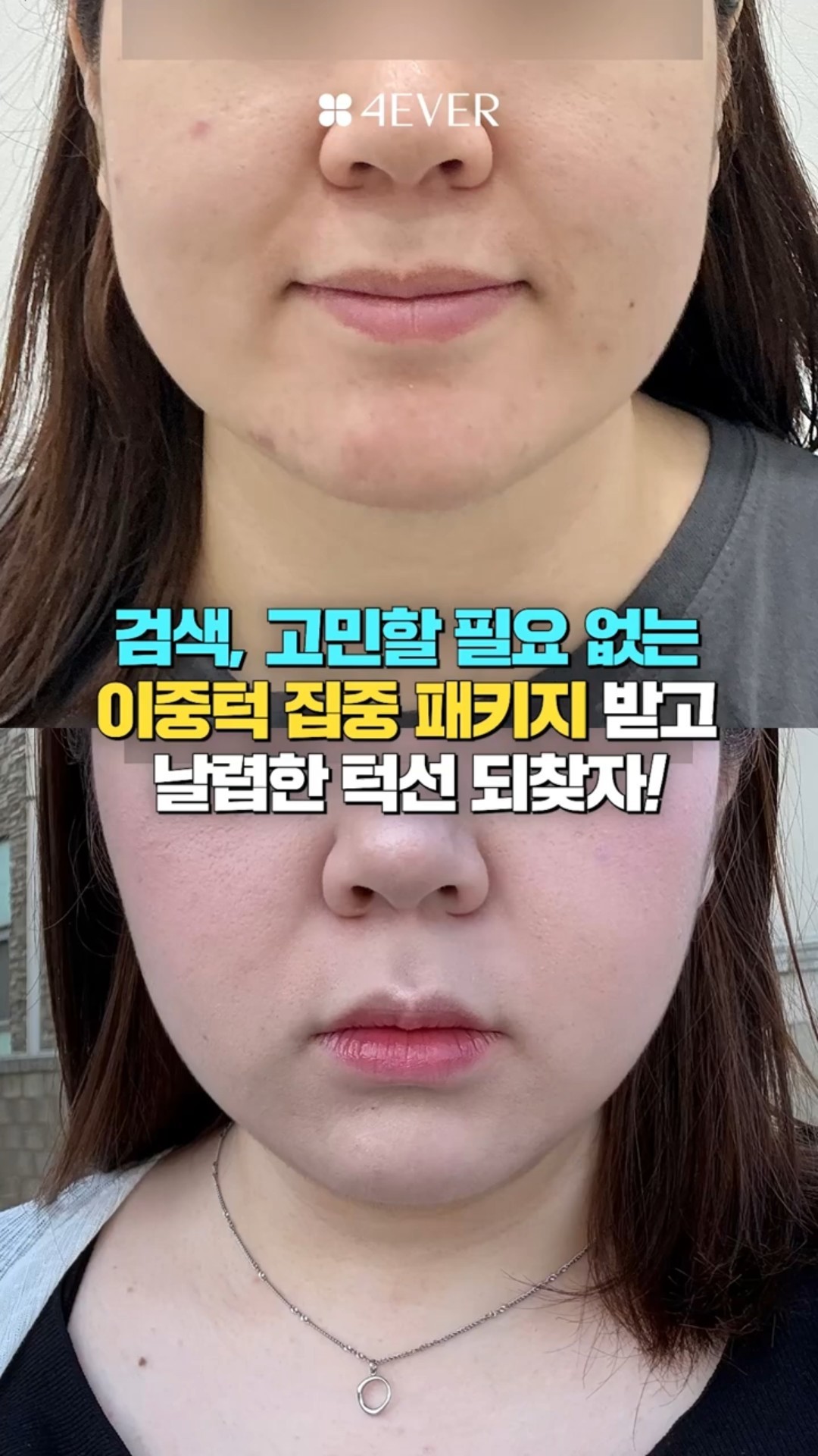 쇼츠