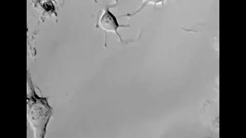 Migrating neuronal cells